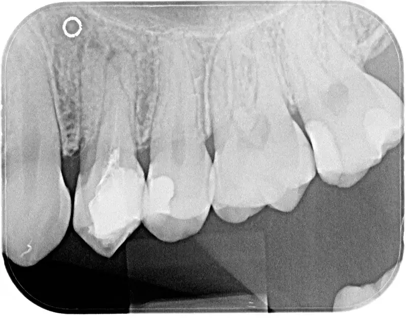 3 Kanäle Eingangsituation